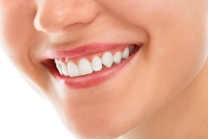 The Importance of Regular Teeth Whitening The Colony Maintenance